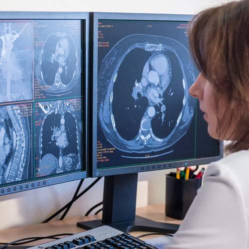 Дистанционный асинхронный курс Рентгенология: КТ и МРТ