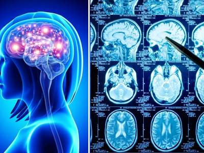 Дистанционный курс по физическим основам МРТ и методике проведения МР-исследований головного мозга и позвоночника.