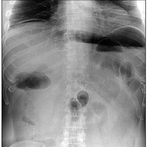 Курс по рентгенодиагностике заболеваний желудочно-кишечного тракта.