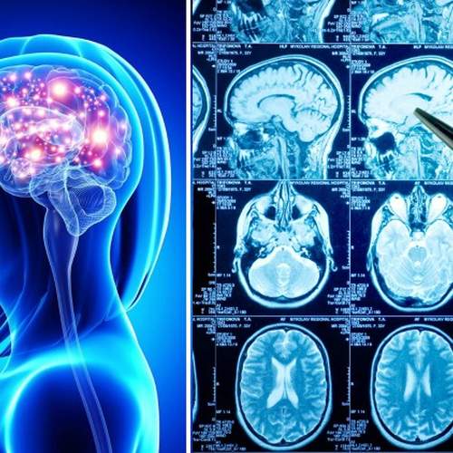 Дистанционный курс по физическим основам МРТ и методике проведения МР-исследований головного мозга и позвоночника.